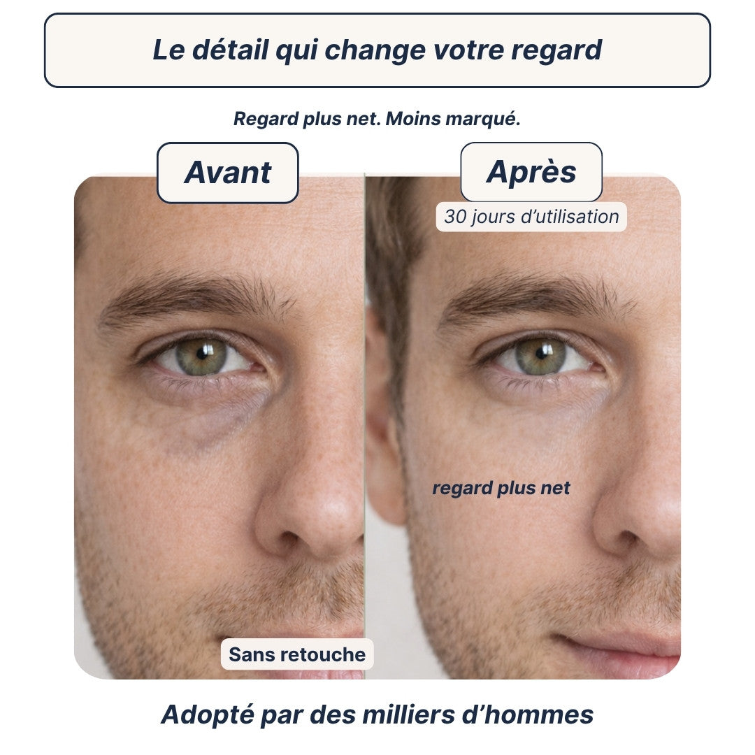 Patchs Anti-Cernes Hydrogel — Regard frais en 10 minutes