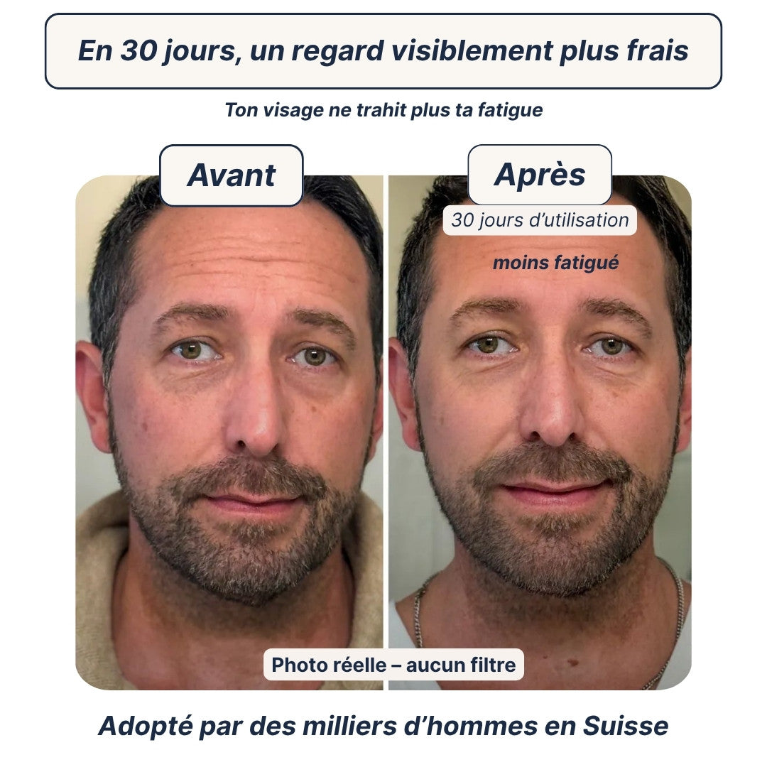 Patchs Anti-Cernes Hydrogel — Regard frais en 10 minutes