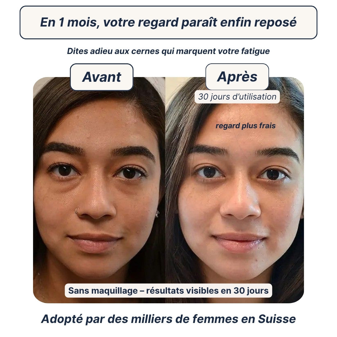 Patchs Anti-Cernes Hydrogel — Regard frais en 10 minutes