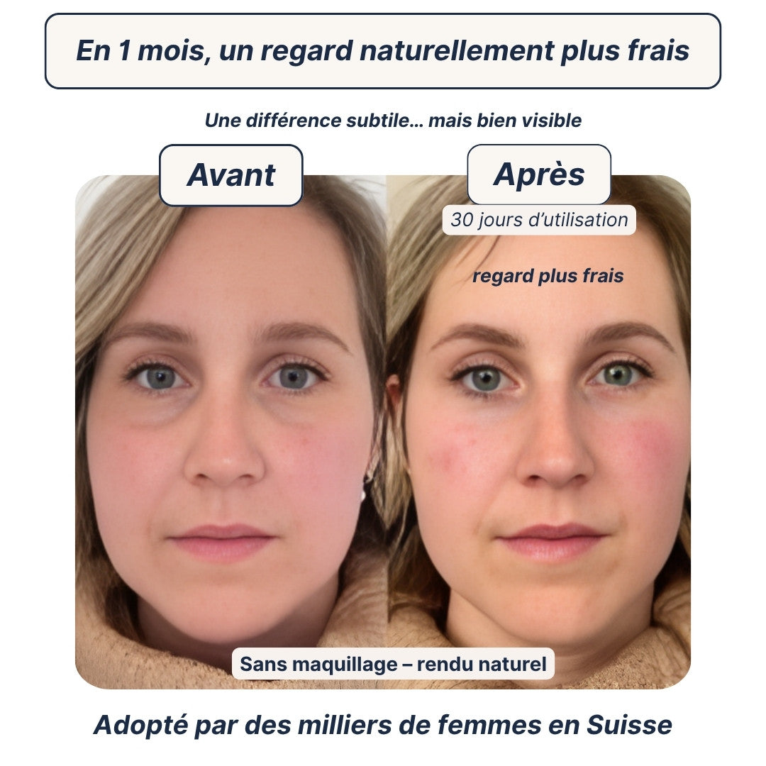 Patchs Anti-Cernes Hydrogel — Regard frais en 10 minutes