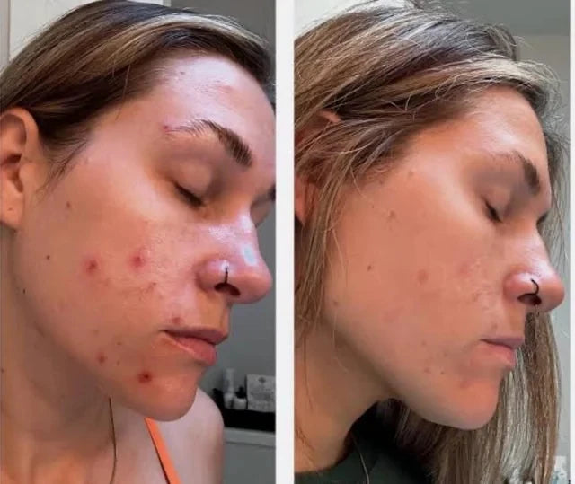 HEYDN — Crème des Alpes